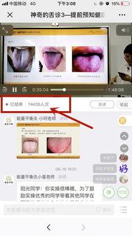 舌诊在线视频全集,揭秘中医舌诊奥秘
